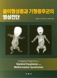 골이형성증과 기형증후군의 영상진단 = Imaging diagnosis of skeletal dysplasias and malformation syndromes / 지은이: 김옥화, 니시무라 겐, 조태준